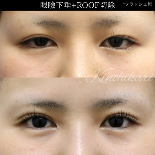 CASE01 術後