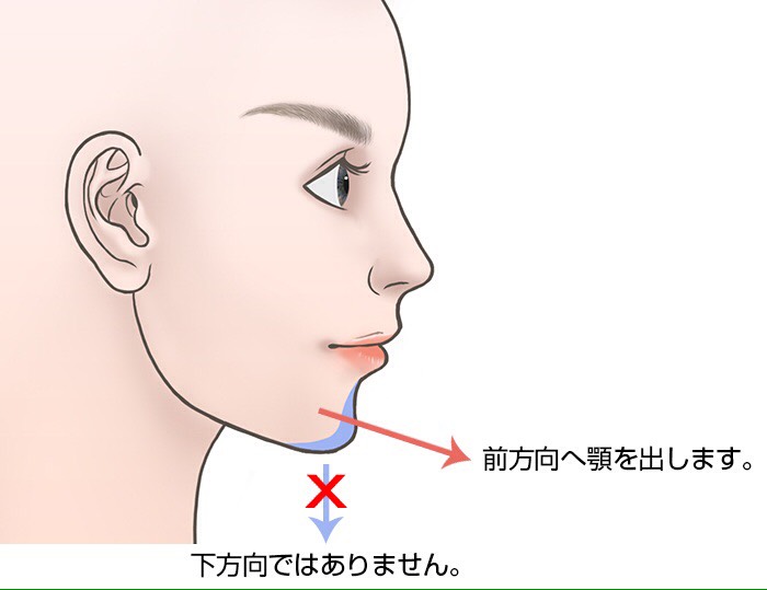 ヒアルロン酸による小さい・低いあごの治療注意点1