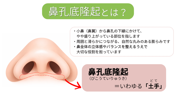 鼻孔底隆起とは