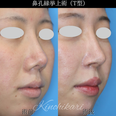  鼻先とのバランスが悪い