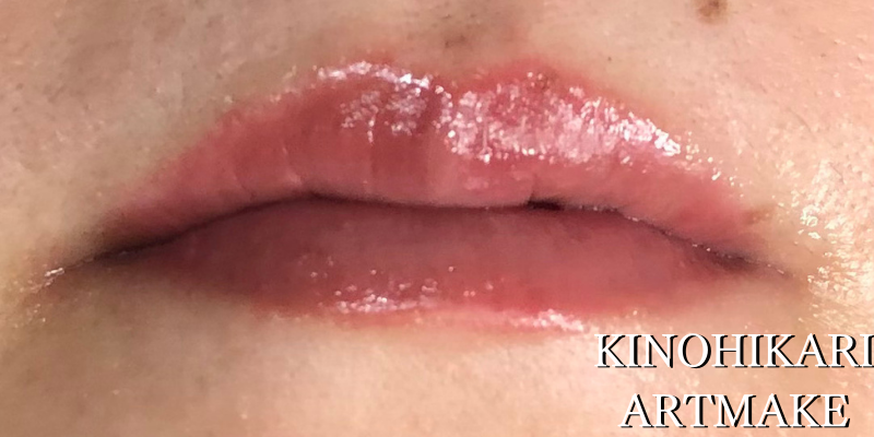 【アートメイクフルリップ】唇のクスミ改善　30代女性【症例No.29K0000461】